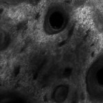 Cute del viso in microscopia confocale: derma alto