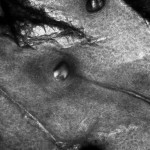 Cute del viso in microscopia confocale: epidermide alta